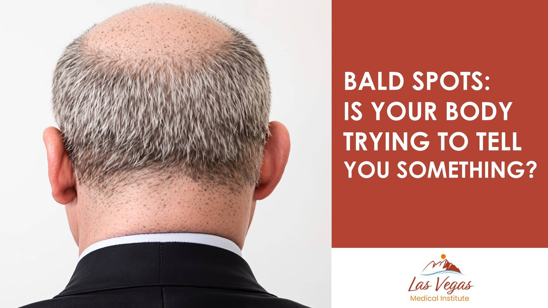 Bald Spots: Is Your Body Trying to Tell You Something? by Las Vegas Medical Institute