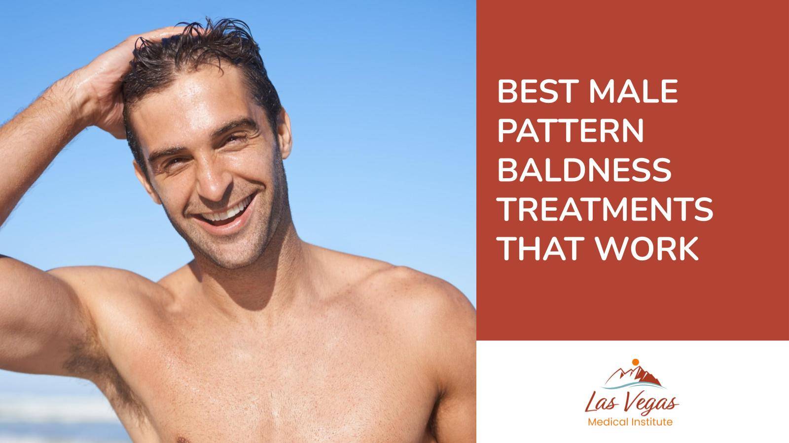 Best Male Pattern Baldness Treatments That Work By Las Vegas Medical Institute