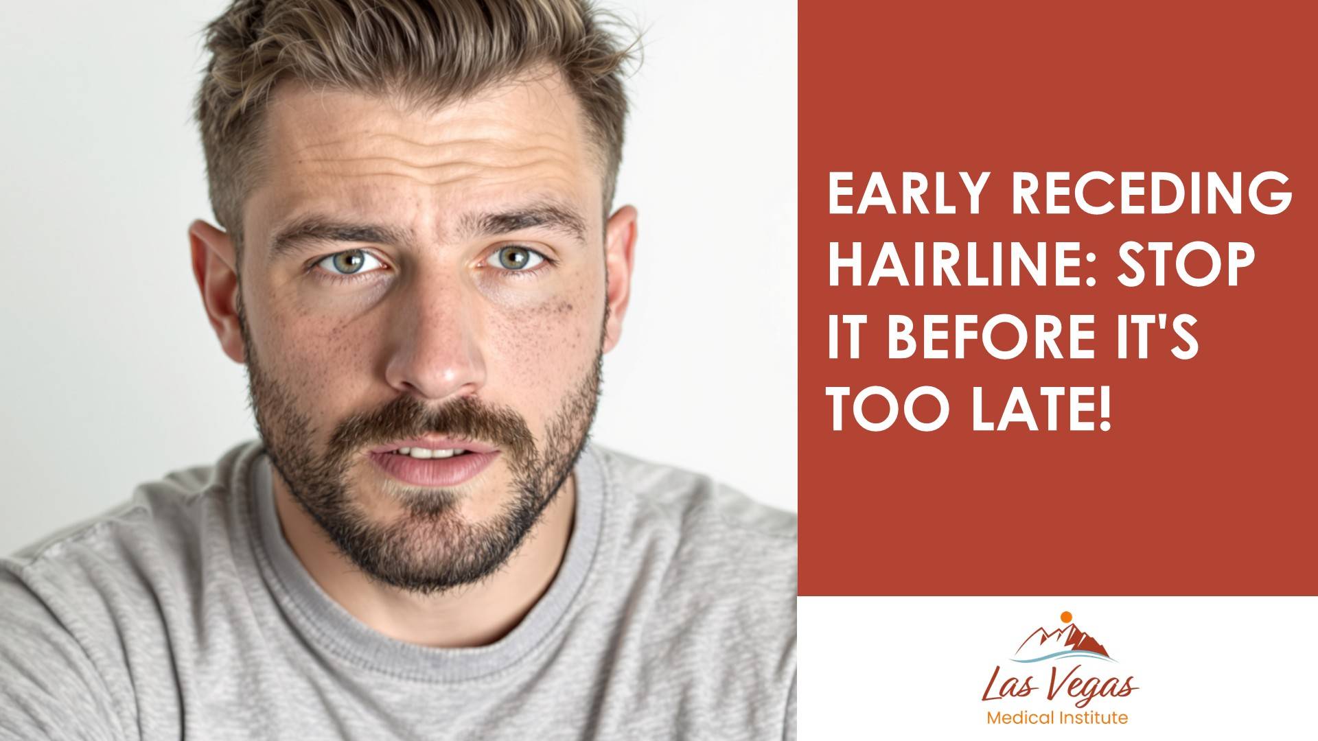 Early Receding Hairline: Stop It Before It&# ;s Too Late!