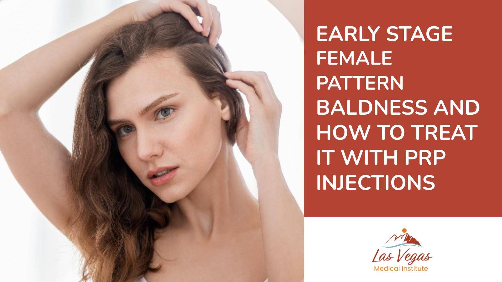 Early Stage Female Pattern Baldness and How to Treat it With PRP Injections By Las Vegas Medical Institute