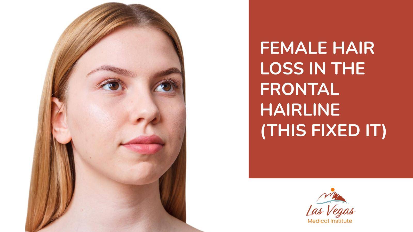 Female Hair Loss in the Frontal Hairline (This Fixed It) By Las Vegas Medical Institute