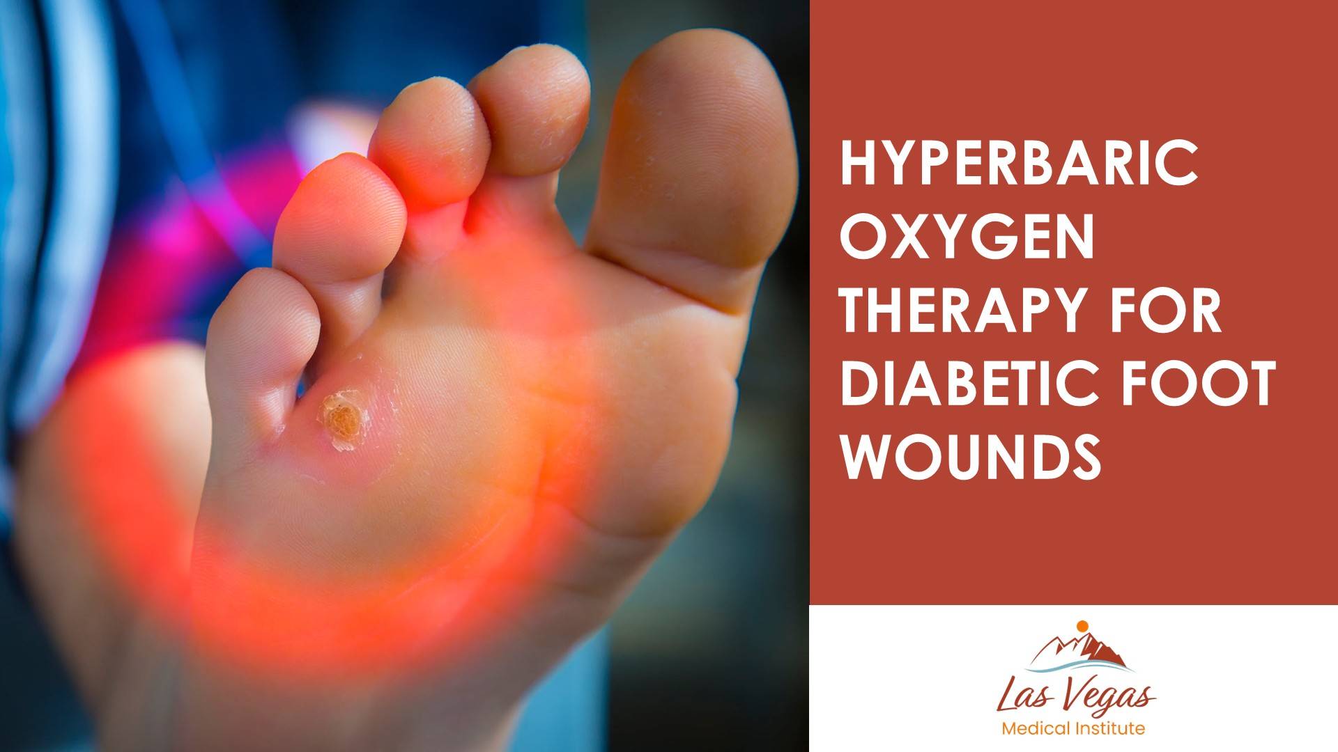 Hyperbaric Oxygen Therapy for Diabetic Foot Wounds By Las Vegas Medical Institute