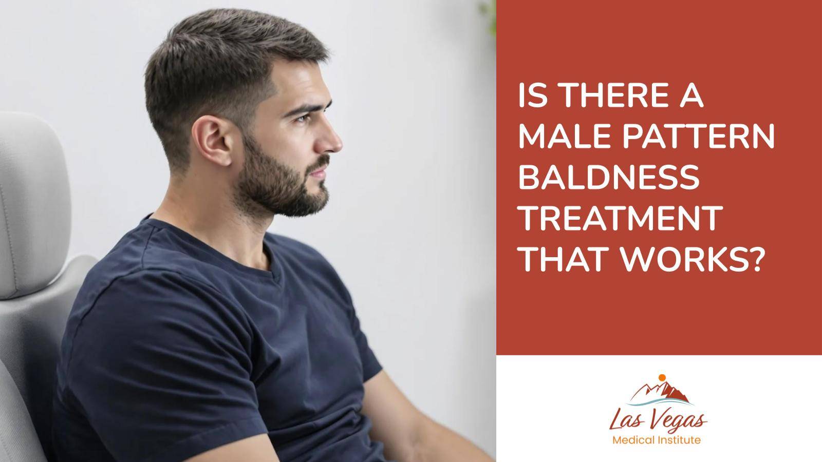 Is There A Male Pattern Baldness Treatment That Works?