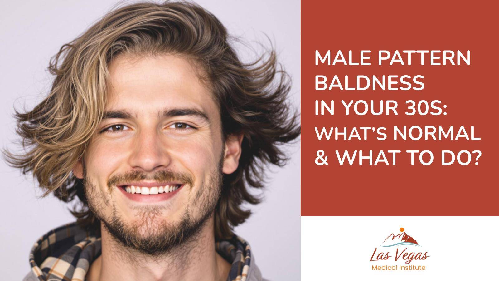 Male Pattern Baldness in Your 30s: What’s Normal and What To Do? By Las Vegas Medical Institute