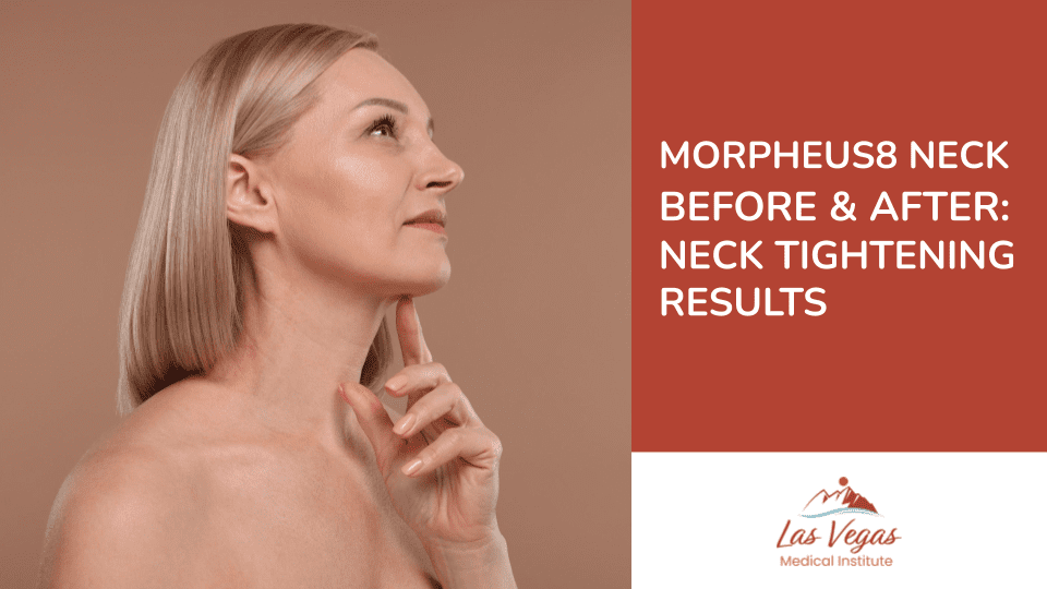 Morpheus  Neck Before And After: Neck Tightening Results