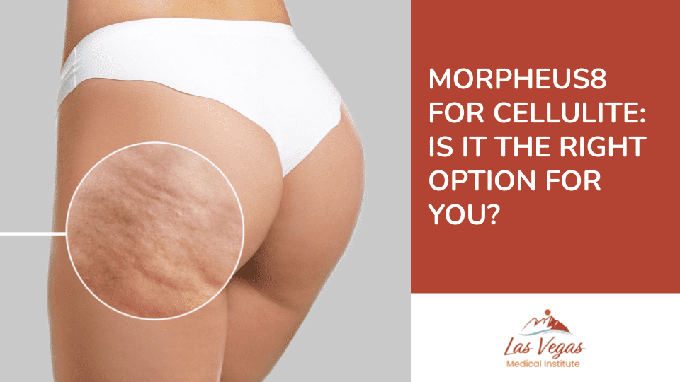 Morpheus8 for Cellulite: Is it the Right Option for You? by Las Vegas Medical Institute
