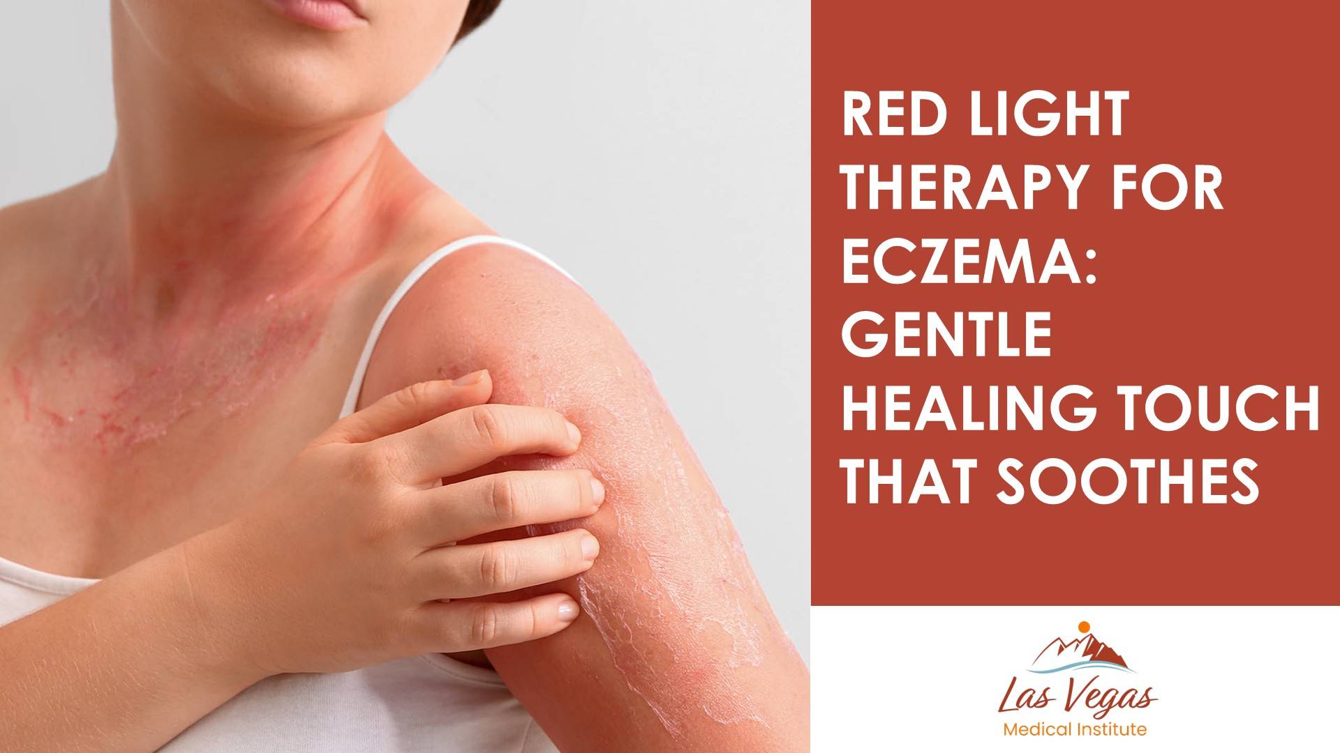Red Light Therapy for Eczema: Gentle Healing Touch That Soothes By Las Vegas Medical Institute