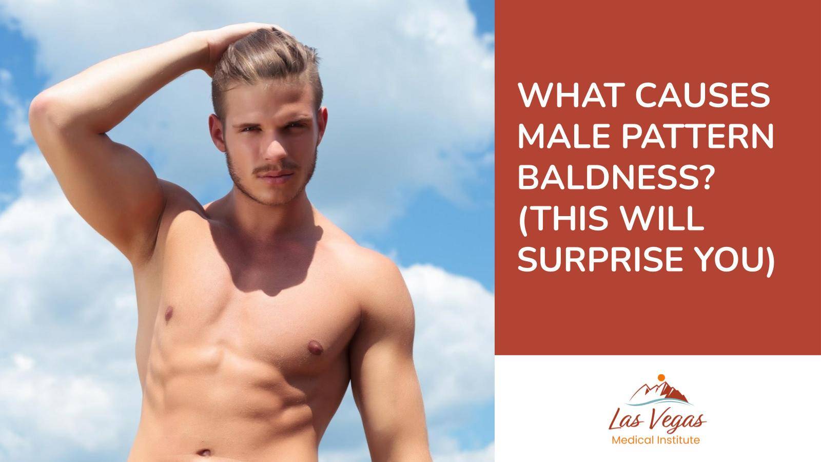 What Causes Male Pattern Baldness? (This Will Surprise You) By Las Vegas Medical Institute